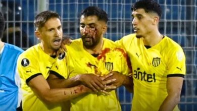 Photo of Escándalo en Central-Peñarol: un jugador uruguayo ensangrentado