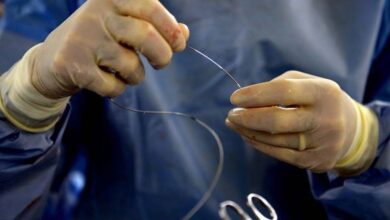 Photo of Los cardiólogos harán paro por dos días y no colocarán stents ni realizarán angioplastias