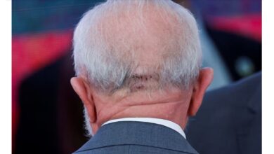 Photo of Otra cirugía craneal: Lula está «despierto y hablando» tras el nuevo procedimiento