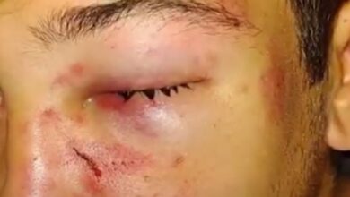 Photo of Golpiza en patota contra un joven en un boliche de Villa Allende