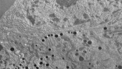 Photo of Terapia para frenar el crecimiento de tumores cerebrales